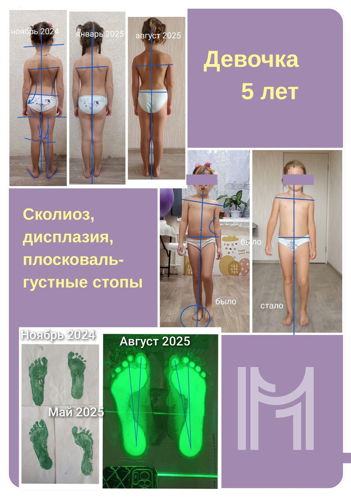Результат