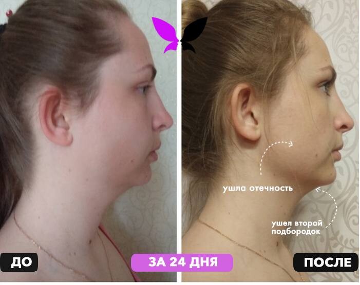 Результат
