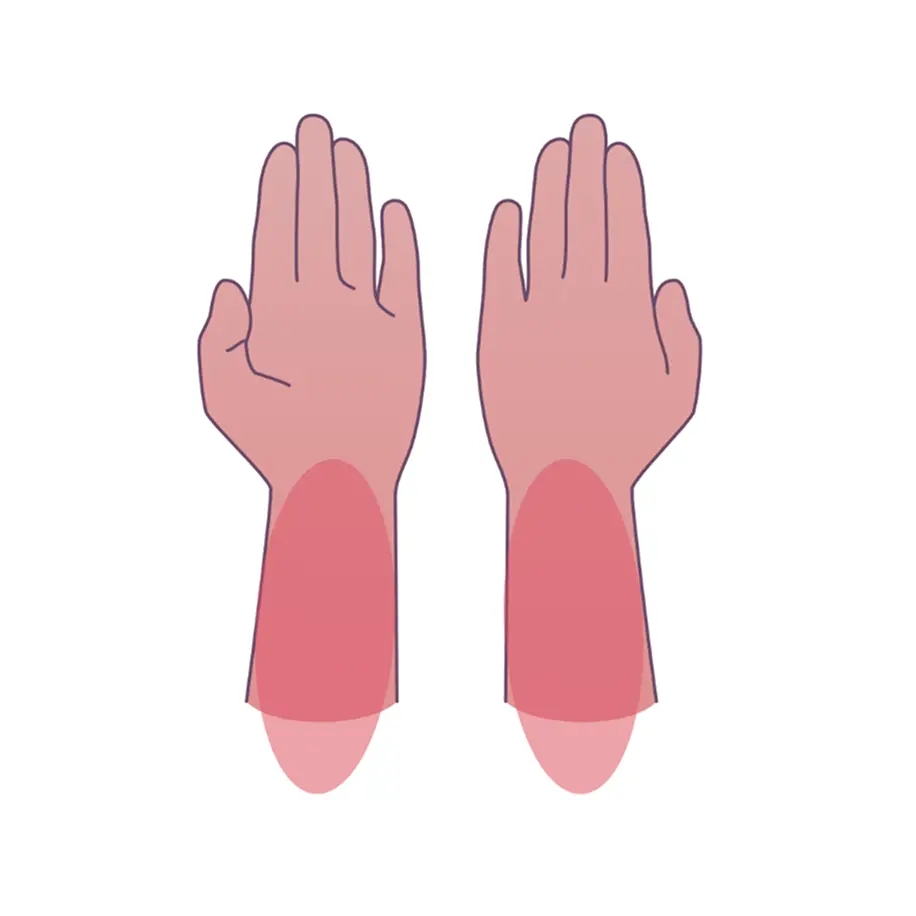 внутренний поворот предплечья