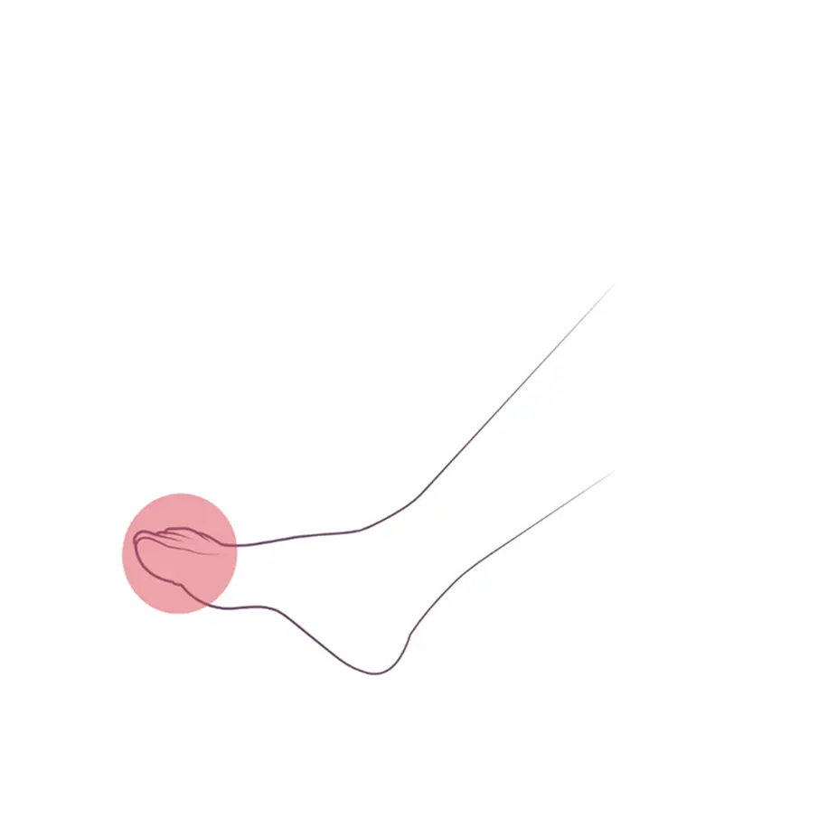 подошвенного сгибания стоп