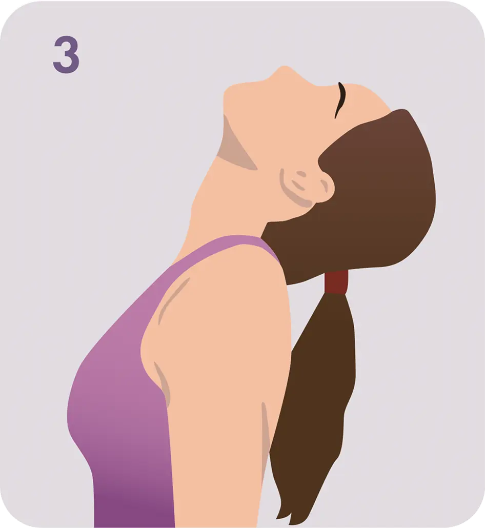 Запрокидывание Ретроколлис