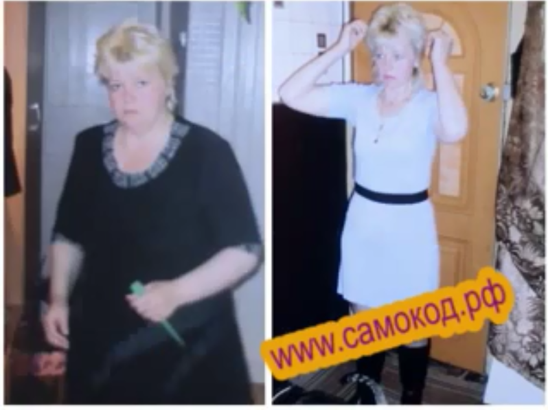 Видео-отзыв пациентки 1